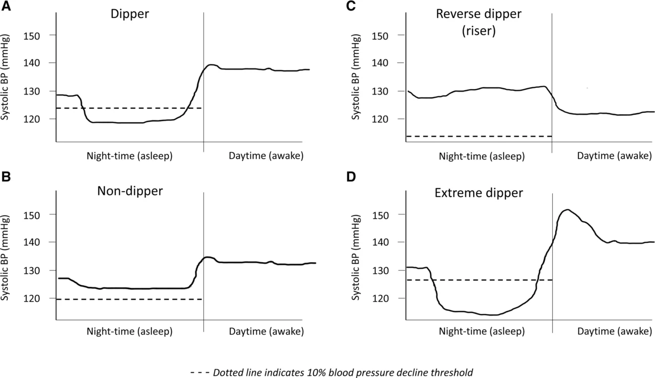 Blood Pressure Dipping Patterns